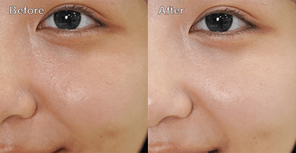 E***** L****, Kuala Lumpur